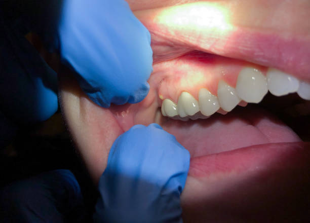 Best Mobile Emergency Dentist in Shiloh, PA